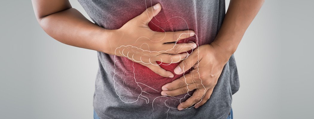 IBS Treatment